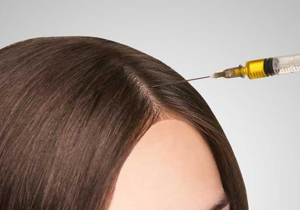 photo of doctor injecting stem cells into patients head